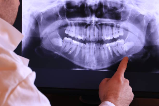 Best Emergency Denture Repair in Troy, PA