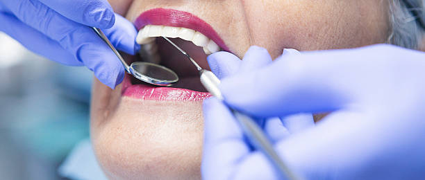 Best Knocked-Out Tooth (Avulsed Tooth) Treatment in Troy, PA
